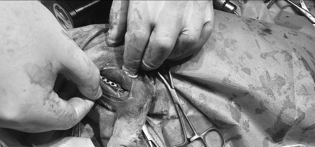 Cerrahi Müdahaleler